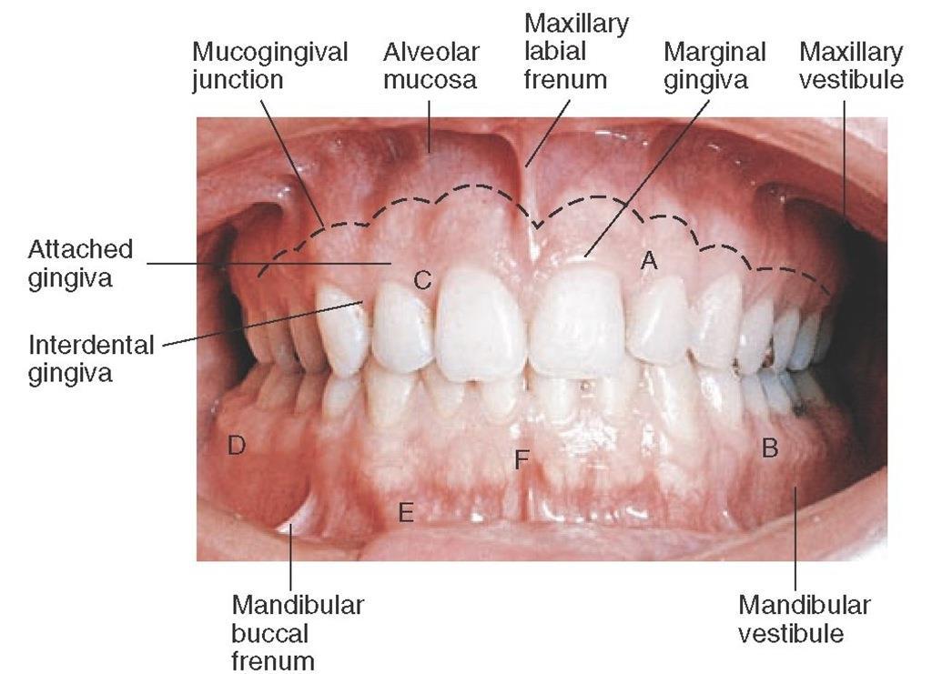 VESTÍBULO ORAL - Espacio virtual entre labios y mejillas y procesos dentoalveolares.