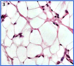c) TEJIDO ADIPOSO Es una variedad del Tejido conectivo y están formados por células llamadas ADIPOCITOS, que son grandes, esféricas y llenas de grasa.