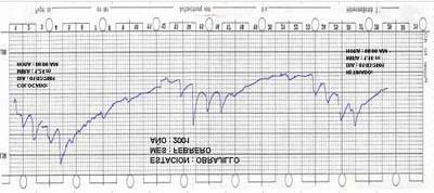 Fig. Nº 05 Banda Limnimétrica 3.2.1 METODO DEL MOLINETE O CORRENTOMETRO 3.2.1.1GENERALIDADES El correntómetro es el instrumento de precisión que mide la velocidad del agua en los puntos de medición de una sección de control.