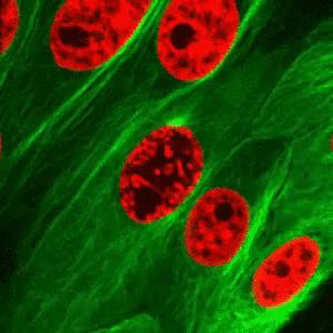 Algunos pigmentos, como las clorofila presentan autofluorescencia, es decir pueden visualizarse directamente las células si son