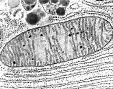 MITOCONDRIA MET MITOCONDRIA MEB CRIOFACTURA Es una técnica de microscopía electrónica especialmente utilizada para estudiar los componentes de la membrana.