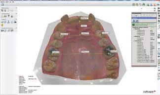 CAD/CAM Modelos de estudio digitales Servicios de análisis ortodóncicos Servicios de planificación del tratamiento