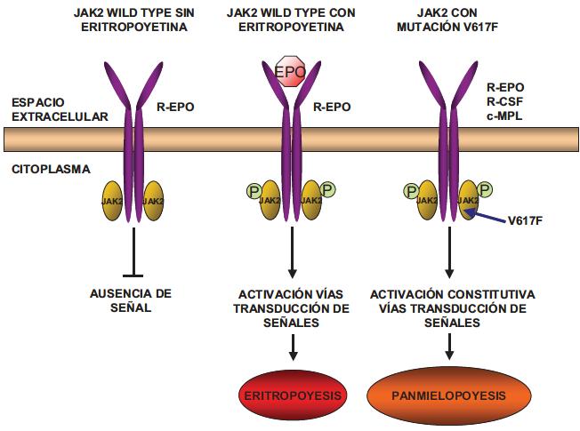 Policitemia Vera Mutación V617F en el gen Janus Kinasa 2 JAK2 (V617F) Valina Fenilalanina En 2005 se describió una mutación adquirida situada en el exon 14 del gen de la quinasa JAK2
