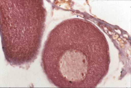 previtelogénico Membrana nuclear lisa Citoplasma basófilo