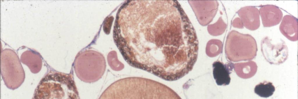 3) Folículo maduro Citoplasma perinuclear rodeando la vesícula