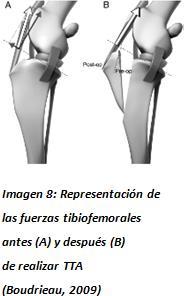 Las premisas de la técnica TTA están basadas en un análisis realizado con modelos biomecánicos sobre las fuerzas de la articulación en la rodilla humana.