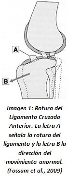 Many surgical procedures have been described to stabilize the affected knee in the last years. Such treatments can be divided into intra-capsular, extra-capsular and proximal tibial osteotomies.