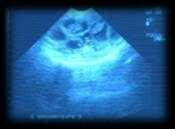 probable parto Preñada/Fallada Utilidad