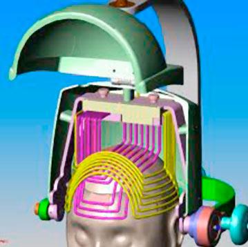 Transcranial Magnetic Stimulation (TMS) Motor cortical mapping: Stimulus site is located by using a latitude/longitude