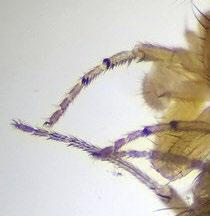 Característica 4: Presencia de peines negros en el tarso de las patas delanteras de los machos. Esta es una característica exclusiva o carácter diagnóstico de machos de Drosophila suzukii.