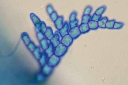 Acrochaetium microscopicum (Nägeli ex Kützing) Nägeli Acrochaetiales Florideophyceae Acrochaetiaceae Algas erectas, filamentosas, epífitas, de 100-600 µm de alto, color