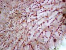 Tetrasporangios ovoides, con división cruciada, de 25-50 µm de largo y 25-30 µm de ancho, originándose esparcidamente desde las células corticales, en las