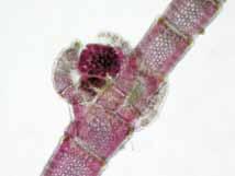 Carposporofito con gonimocarpos esféricos, de 100-150 µm de diámetro, rodeados por ramas involucrales. FPNALR (Isla Larga).