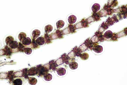 Nudos de 36-40 µm de ancho, formado por 2-3 hileras de células, 4 células periaxiales, ovoidales a cuadrangulares.