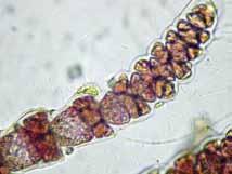 Tetrasporangios tetrahédricos, ovoides a piriformes, sésiles o pedunculados, de 29-33 µm de diámetro y 36-41 µm de largo,