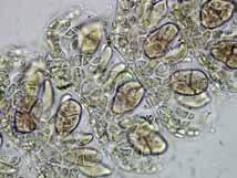 Tetrasporangios tetrahédricos, ovoides a piriformes, sésiles, de 30-35 µm de ancho y 40-45 µm de largo, creciendo verticiladamente,