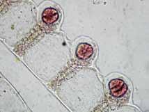 células pseudoperiaxiales presentes. Células acrópetas de forma ovoidal, formando de 1-2 hileras. Células basípetas ausentes.