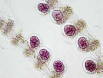 Células acrópetas formando de 1-2 hileras, generalmente 1, de forma ovoidal. Células basípetas y pseudoperiaxiales ausentes.