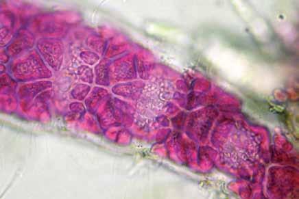 Tetrasporangios tetrahédricos, esféricos a ovoides, sésiles, de 23,3-36,0 µm de diámetro originándose de las células periaxiales, inmersos en el talo, totalmente rodeados por células corticales,