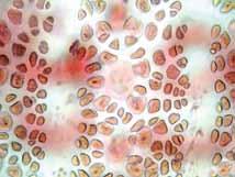 ovoides. Células acrópetas y basípetas de forma ovoidal, formando de 3-4 hileras.