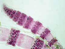 Nudos de 45,7-67,0 µm de ancho y 19,3-43,3 µm de largo, formando 5 hileras de células, con 5-6 células periaxiales,