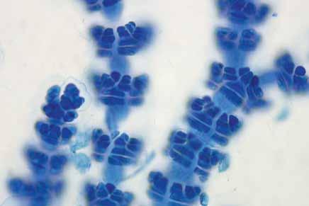 Ramificación abundante, pseudodicotómica o alterna, a intervalos de 4-5. Ápices complanados, principalmente rectos o ligeramente incurvados. Células glandulares ovoidales.