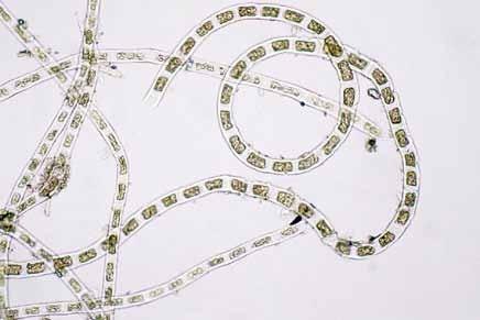 Chaetomorpha gracilis Kützing Chlorophyta Cladophorales Ulvophyceae Cladophoraceae Algas filamentosas, erectas, intrincadas, color verde amarillento, 15-20 cm de alto, fijadas al
