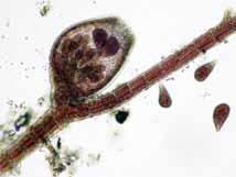Cistocarpos ovoides a urceolados, con un pedúnculo corto, de 150-200 µm de diámetro. FPNALR (Cayo Pirata, Cayo Sal, Dos Mosquises Sur).