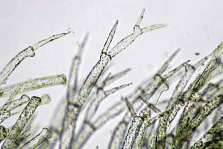 Wrangelia bicuspidata Børgesen Ceramiales Florideophyceae Wrangeliaceae Detalle de la ramificación. Escala 150 µm.