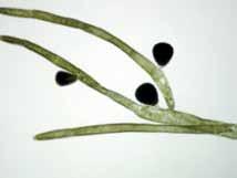 Derbesia marina (Lyngbye) Solier Chlorophyta Bryopsidales Ulvophyceae Derbesiaceae Algas filamentosas,