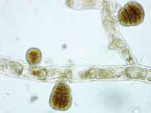 Células de 30-60 µm de largo y 20-30 µm de ancho. Cloroplastos numerosos pequeños y discoidales.