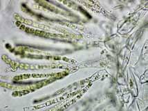 Células medulares externas, subcilíndricas, de 120-130 µm de largo y de 55-65 µm de ancho.