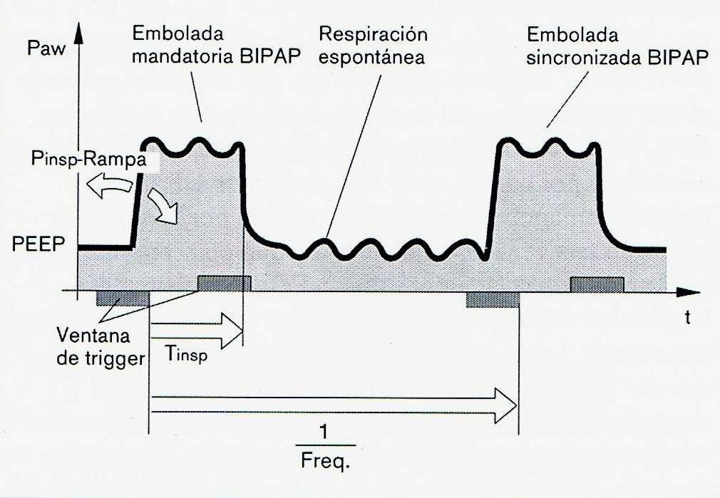BIPAP presión positiva bifásica en la vía aérea. Es un modo de ventilación a presión control. Tb se programa FiO2, Fr, y el tiempo inspiratorio. Se programa la presión durante la inspiración IPAP.