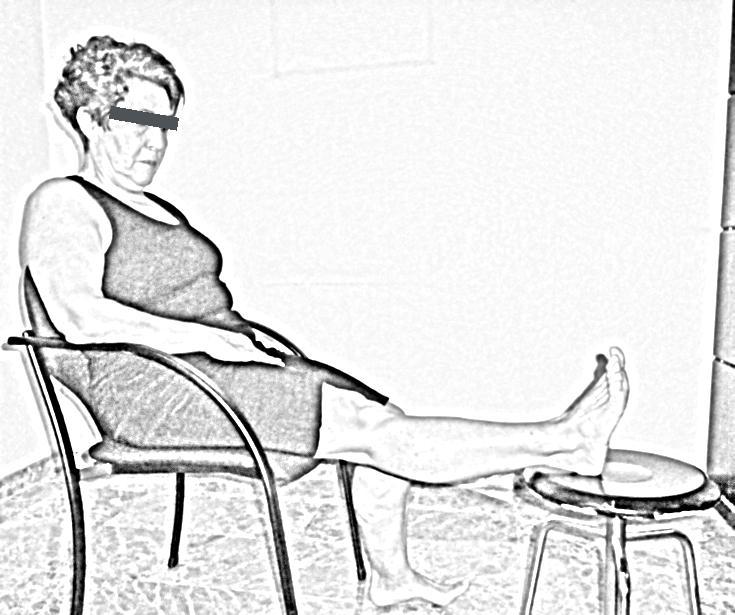 Isométrico de isquiosurales Sentado, con la rodilla semiflexionada (60º) y apoyada en un taburete. Intentar flexionar la rodilla presionado el taburete con el talón.