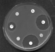 Difusión en agar Dilución en caldo y en agar Metodología Automatización Método epsilométrico (E-test) Facilidad