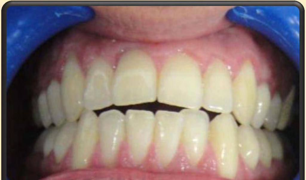 SALUD ORAL Paciente dentado completo Salud