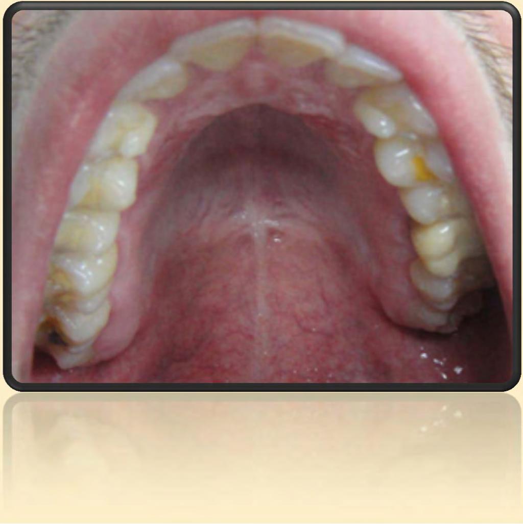 ANAMNESIS Paciente derivado de P. Fija pregrado por diente 2.