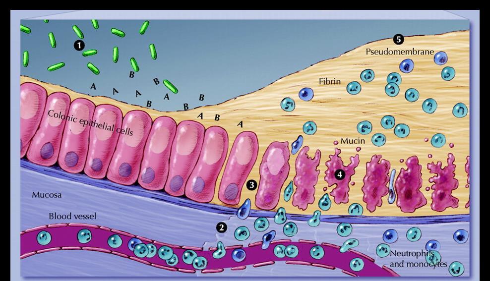 Al inactivar las proteínas Rho también bloquean la fagocitosis de células vegetativas, lo que contribuye a su permanencia Hay muerte de células