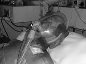 pulmonar: Inspiratorio Espiratorio Mejora el intercambio gaseoso Aumenta el Peak Flow Tusígeno (Volumen pre-tusígeno) Disminuye el atrapamiento aéreo Disminuye la carga