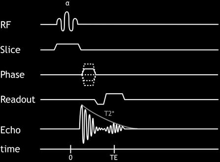 b. Secuencia GRADIENT-ECHO (GE) Las secuencias de pulso de tipo Gradient Echo se caracterizan por utilizar un pulso de readiofrecuencia de intensidad y duración variable que puede lograr un flip