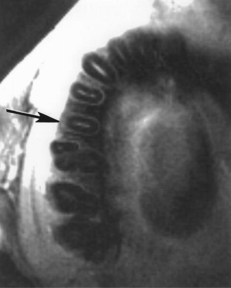 Figura 4.2: Imagen común de los dientes en MRI.[GB03] los gradientes. Como es lógico, esto encarece el coste del equipo.