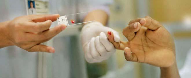 VIII.- Diagnóstico El paludismo es diagnostica mediante la realización de exámenes especiales de sangre, la cual es analizada bajo el microscopio para comprobarse la existencia o no, de parásitos de