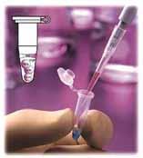 DIAGNOSTICO POR PCR HAY UN 10 15 % DE BACTERIAS QUE NO PUEDE IDENTIFICAR DETECCION DE ADN NO SIGNIFICA INFECCION HAY OTRAS FUENTES POSIBLES DE ADN EN LA LECHE PCR