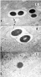 Bovine mammary epithelial cell invasion by Streptococcus
