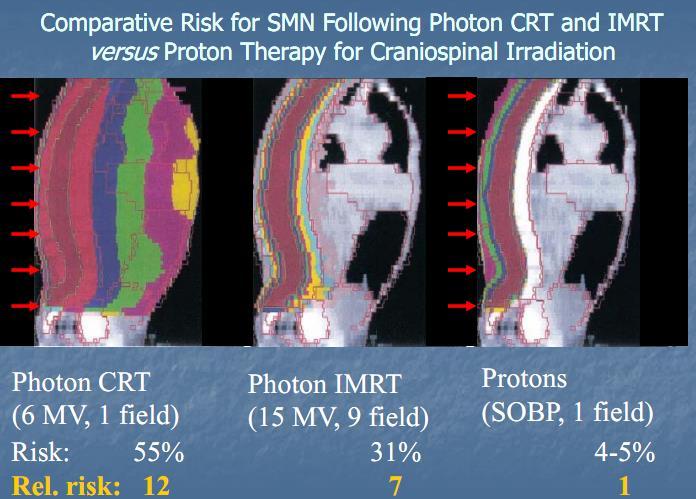 Proton therapy for Pediatric Tumor
