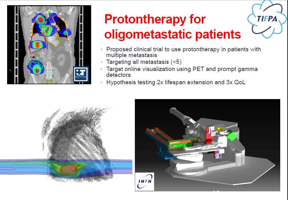 Protontherapy for