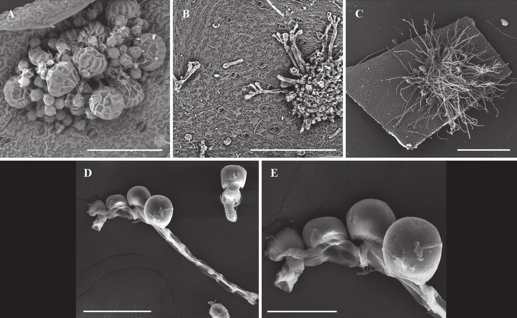 Escala: E: 20 µm; B, C: 100 µm; A: 200 µm; D: 500 µm. Figura 4. Estructuras reproductivas. A: soros maduros con glándulas cerosas (C.