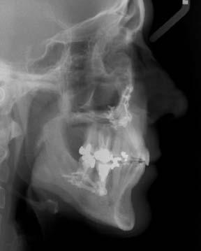 ortodoncia Janer16pag.