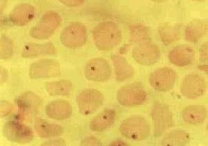 Anaplasma marginale cuerpos de 0.3-1Fm Babesia spp. Entra al eritrocito como forma simple (merozoito), se alimenta y crece (trofozoito).