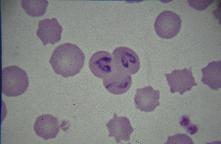 Babesia spp. Entra al eritrocito como forma simple (merozoito), se alimenta y crece (trofozoito).